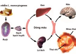 Khuẩn trên táo Mỹ gây bệnh nguy hiểm thế nào?