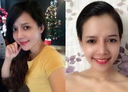 Người đứng sau cuộc phẫu thuật thành công của hotgirl Việt