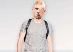 Ribery được gợi ý về các kiểu tóc &#8216;dị&#8217;