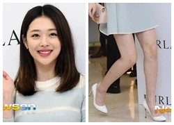 Sulli f(x) bị nghi tiêm chất giảm béo chân