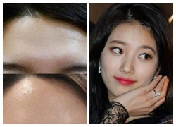 Vẻ đẹp tự nhiên của Suzy (Miss A) bất ngờ bị tố đã từng &#8220;dao kéo&#8221;