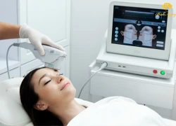 Xóa nhăn cùng chuyên gia Ultherapy, Mỹ