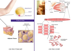 5 lưu ý trước khi giảm mỡ