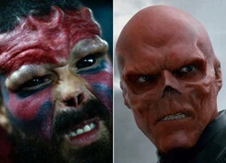 Người đàn ông phẫu thuật cắt mũi để biến thành nhân vật Red Skull