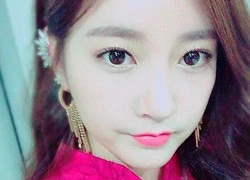 Soyeon (T-ara) bị châm biếm là "quái vật thẩm mỹ" vì mặt cứng đơ