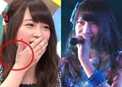 Thành viên AKB48 xuất hiện trở lại sau khi bị fan cuồng chém bằng cưa sắt