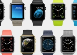 5 hạn chế của Apple Watch