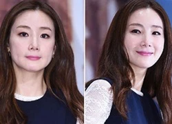 Choi Ji Woo khoe làn da đẹp không tì vết ở tuổi 40