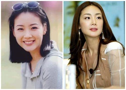 Choi Ji Woo mặt ngày càng &#8216;đơ&#8217; vì phẫu thuật thẩm mỹ