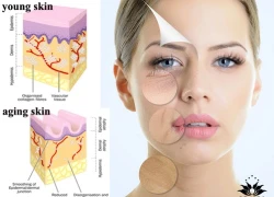 Dấu hiệu da lão hóa nặng ở tuổi 30