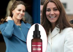 Kate Middleton dưỡng da bằng dầu nụ tầm xuân