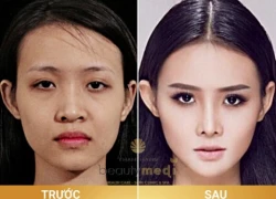 Tân trang nhan sắc bằng phẫu thuật thẩm mỹ