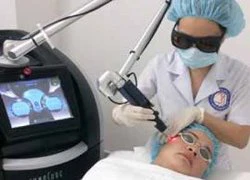 Xóa bớt, làm đẹp da bằng công nghệ Laser