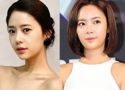 Yoona, Shin Min Ah... vướng nghi án "dao kéo" với ảnh lộ rõ miếng độn trán