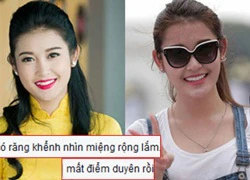 Á hậu Huyền My bị chê 'mất duyên' khi chỉnh răng khểnh