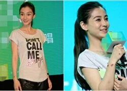 Angelababy gầy guộc, lộ vết thương trên cổ tay