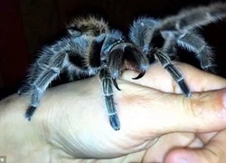 Cô gái nuôi và cưng chiều cho nhện độc tarantula cắn vào tay mình