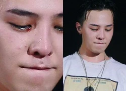 G-Dragon bị chảy máu mắt trong concert trở lại của Big Bang