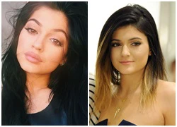 Kylie Jenner lên tiếng về thử thách "bơm môi thủ công"