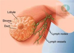 Mách bạn gái cách nhổ lông nách không bị thâm