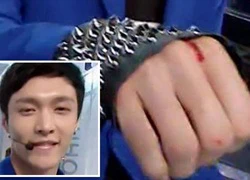 Nghi vấn Lay (EXO) lộ vết thương vẫn chảy máu trên sân khấu