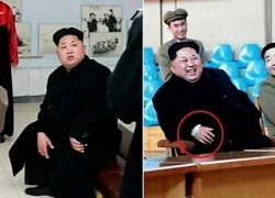 Xuất hiện "vật lạ" trên cổ tay ông Kim Jong-un