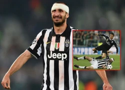 Chiellini đổ máu trong trận cầu căng thẳng