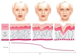 Tại sao phải dùng collagen chính hãng?