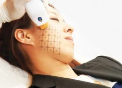 Cách điều trị Thermage theo từng gương mặt