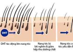 Giải mã cơ chế rụng tóc ở nam và nữ