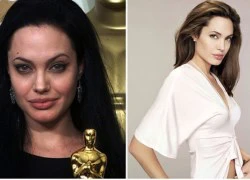 Học Angelina Jolie làm đẹp từ trứng cá muối