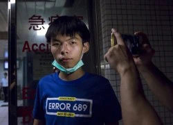 Joshua Wong và bạn gái bị hành hung khi đang hẹn hò