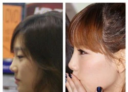 Netizen Hàn tung bằng chứng Taeyeon (SNSD), Chorong (A Pink) sửa mũi