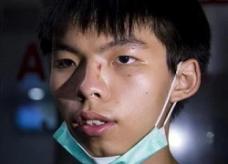 Thủ lĩnh biểu tình Joshua Wong bị hành hung