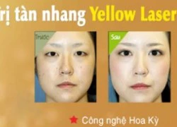 Tìm hiểu những cách trị tàn nhang lâu ngày tại nhà đơn giản