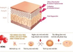 Bí quyết săn chắc và làm mờ rạn da sau sinh