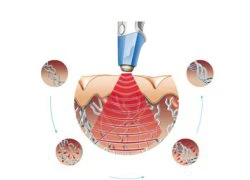 Bí quyết "tút" lại vùng kín sau sinh