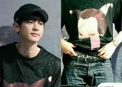 Chanyeol vô tình bị fan soi nội y khi tham dự sự kiện cùng EXO