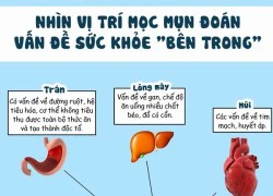 Những vị trí mọc mụn cần "đặc biệt" lưu ý