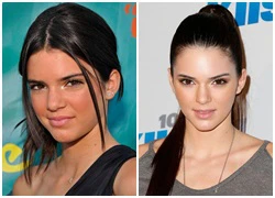 Quá trình thay đổi nhan sắc của Kendall Jenner