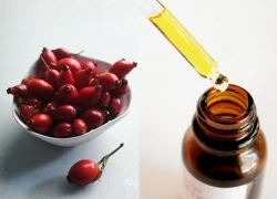 Rosehip oil: Bí quyết đánh thức làn da