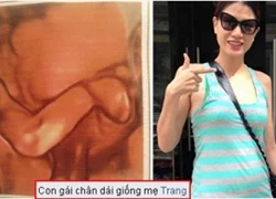 Trang Trần khoe ảnh siêu âm con 'chân dài giống mẹ'