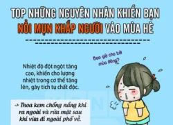 5 nguyên nhân "cơ bản" khiến mụn mọc khắp người vào mùa hè