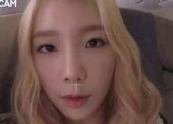 Bằng chứng Taeyeon (SNSD) phẫu thuật thẩm mỹ mắt gây tranh cãi