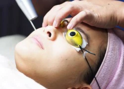 &#8216;Bùng nổ&#8217; chữa tàn nhang Laser ngày đầu thu