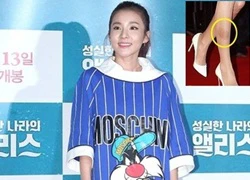 Dara (2NE1) bị soi đôi chân tì vết, đọ sắc cùng Moon Geun Young