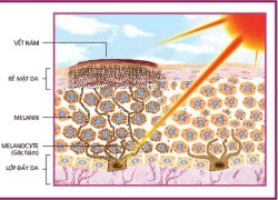 'Khai tử' những sắc tố hình thành nám da