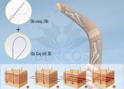 Quay ngược tuổi xuân với &#8220;boomerang bằng nano vàng&#8221;