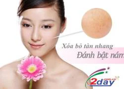 Transino Whitening xóa tan nỗi ám ảnh sạm nám của phụ nữ sau sinh