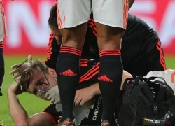 NÓNG: Luke Shaw phải phẫu thuật lần 2